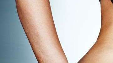 La cirugía de los glúteos, que quedan firmes, más redondos y más grandes, puede llega a costar hasta $12,000.