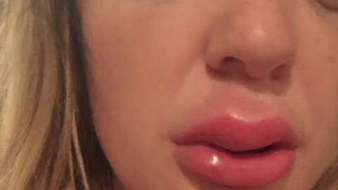 Jessica Bennett  sufrió de inflamación por una semana.