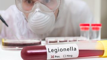 Anualmente, un promedio de 200 a 400 casos de la enfermedad de Legionario son diagnosticados en la ciudad.