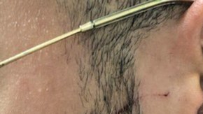 El oficial herido y el arma usada