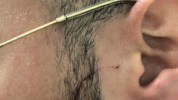 El oficial herido y el arma usada