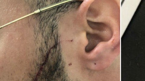 El oficial herido y el arma usada