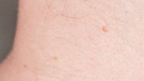 Mucho cuidado con las protuberancias que aparecen de momento.