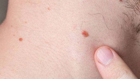 Mucho cuidado con las protuberancias que aparecen de momento.
