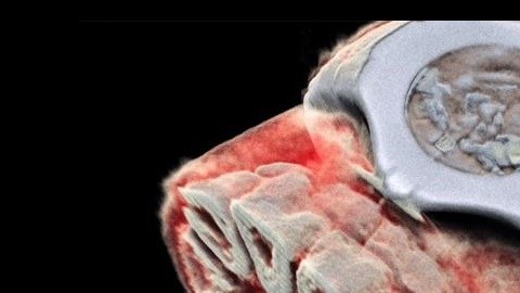 radiografia color
