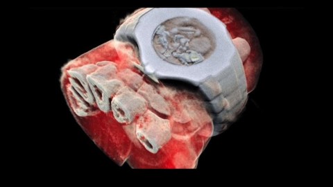 radiografia color
