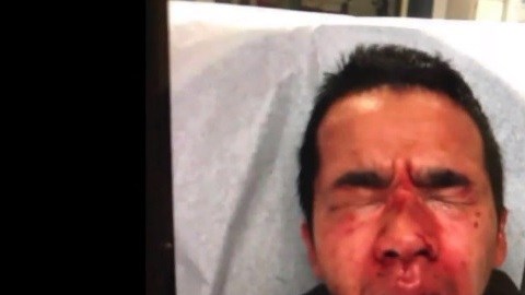 El guardia después de la agresión