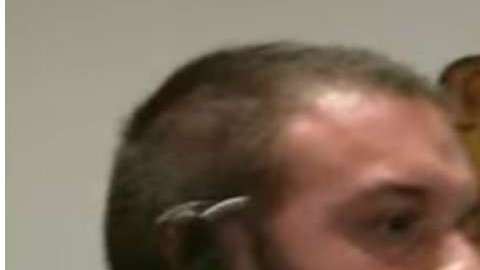 Por muy poco, la mordida no fue letal.