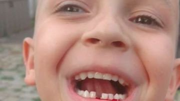 Un niño deja que su padre le arranque uno de sus dientes con un dron.