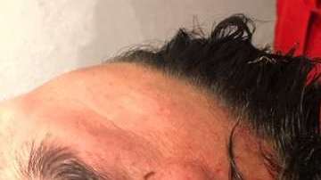 Juan Pablo Vigón sufrió una herida de consideración