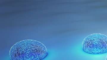 La supervivencia al cáncer ha aumentado mucho en países ricos.