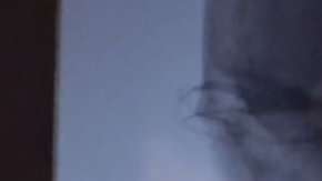 Fue un milagro que el pincho no atravesara ningún vaso sanguíneo importante ni los ojos o cerebro del niño.