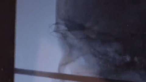 Fue un milagro que el pincho no atravesara ningún vaso sanguíneo importante ni los ojos o cerebro del niño.