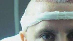 Se estima que más de 60,000 hombres viajan al año a la capital turca a realizarse este tratamiento.