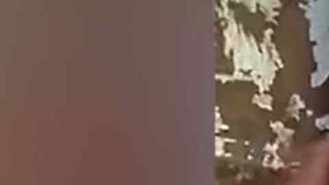 La extraña condición se debe a una mutación genética llamada síndrome de cíclope.