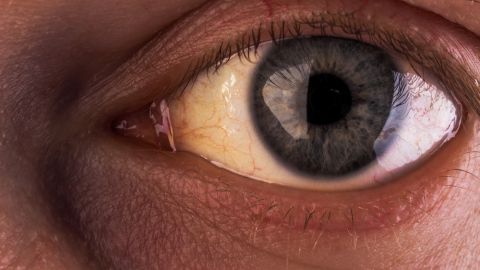 ojos amarillos