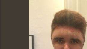 Así quedó tras teñirse el pelo.