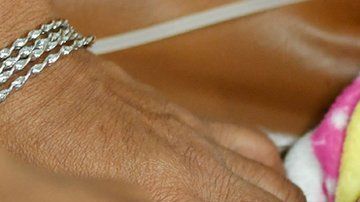 Las cesáreas pueden salvar vidas, pero también se corren riesgos innecesarios.