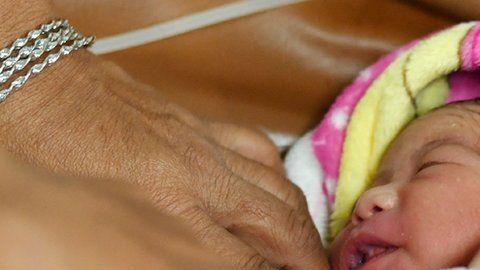 Las cesáreas pueden salvar vidas, pero también se corren riesgos innecesarios.