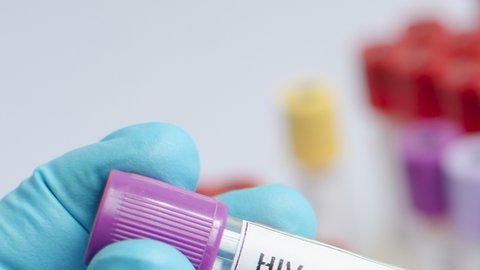 Los trasplantes de células madre como una posible vía para eliminar el VIH del organismo.