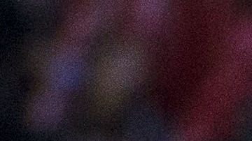 Maradona sufre de artrosis en las rodillas, enfermedad que le impide caminar con facilidad