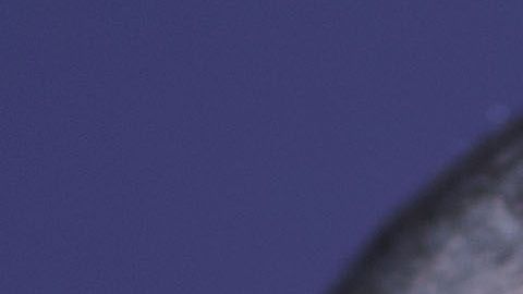 Justin Timberlake sufre una afección.