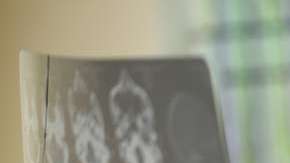 Doctora revisando tomografía cerebral