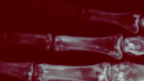 ¿Te implantarías el microchip para pagar sin tarjeta?