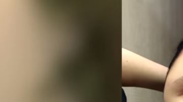 A las pocas horas de haberse aplicado el tinte, así quedó su cabeza.