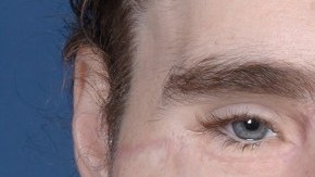 Cameron Underwood con el rostro reconstruido