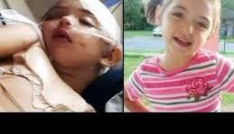 Adryanna Nicole después de recibir el impacto de un muebre y un televisor.