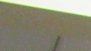 El doctor William Li, MD, director del Departamento de Oncología de Radiación, muestra el equipo de radiocirugía conocido como "acelerador lineal".