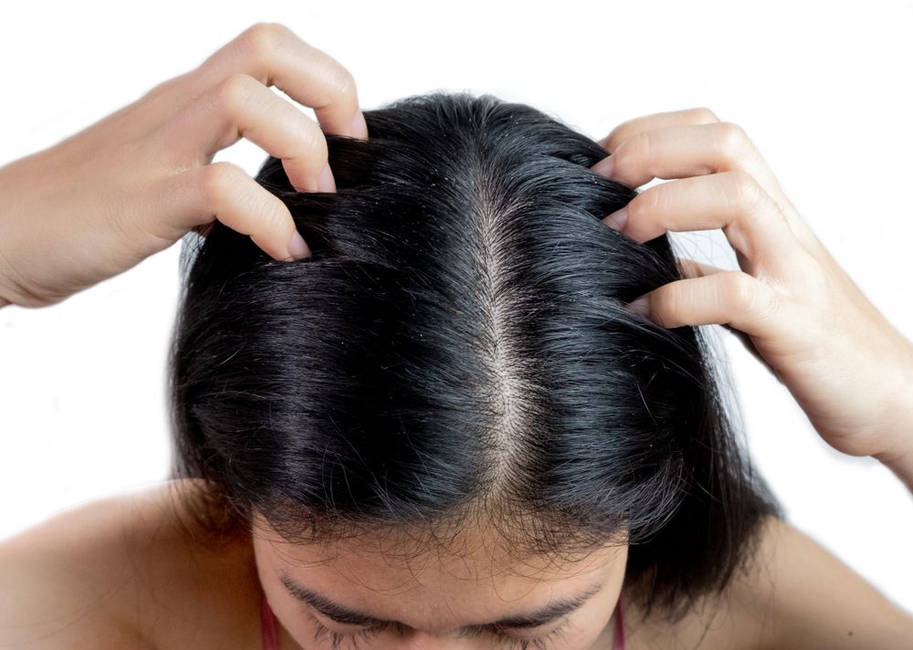 4 trucos para tratar un cabello graso El Diario NY