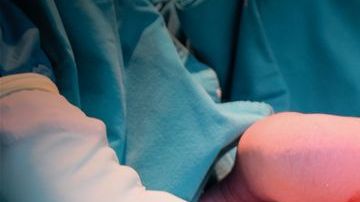 El doctor realizó la cirugía en estado inconveniente.