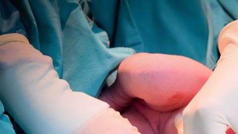 El doctor realizó la cirugía en estado inconveniente.