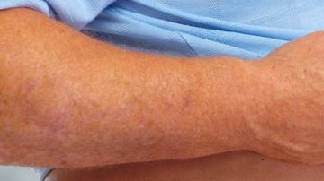 El exceso de ruido puede desencadenar trastornos en el metabolismo.