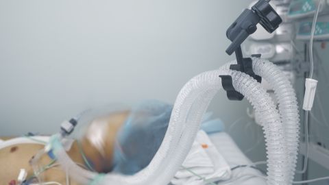 coma