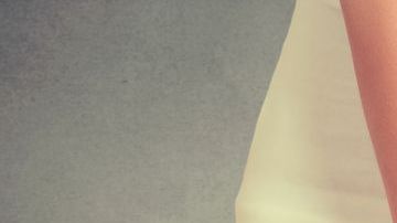 La mujer asegura que debe someterse a una cirugía reconstructiva.