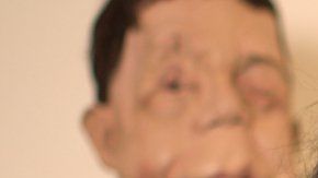Mientras hacía el documental, Arooj Aftab conoció a Adam Pearson, que también padece NF1.