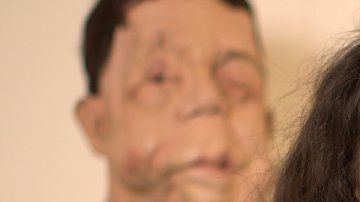 Mientras hacía el documental, Arooj Aftab conoció a Adam Pearson, que también padece NF1.