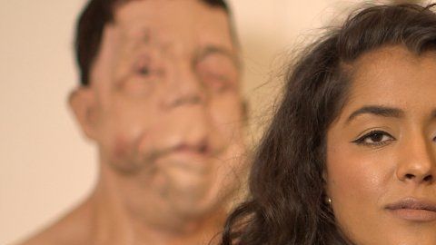 Mientras hacía el documental, Arooj Aftab conoció a Adam Pearson, que también padece NF1.