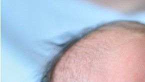 Los bebés registraron 40% menos de actividad de dolor en el cerebro.