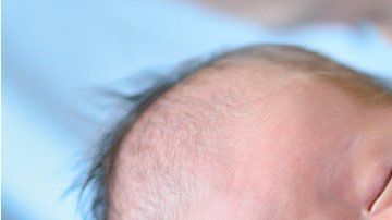 Los bebés registraron 40% menos de actividad de dolor en el cerebro.