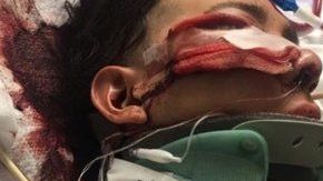 Luis López de 18 años quedó inconsciente tras un golpe en la cabeza