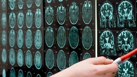La revolucionaria técnica, denominada Clarity, consiste en un proceso químico  que pone transparente al cerebro sin alterar su forma ni conexiones.
