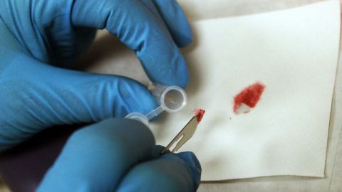 Se estima que hay cientos de miles de "rape kits" almacenados en departamentos de policía y laboratorios forenses a lo largo del país.