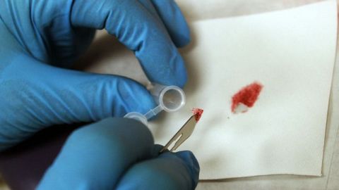 Se estima que hay cientos de miles de "rape kits" almacenados en departamentos de policía y laboratorios forenses a lo largo del país.