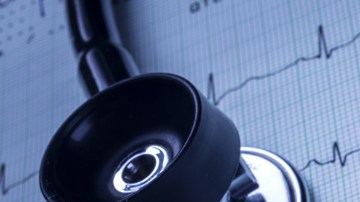 electrocardiograma