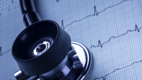 electrocardiograma
