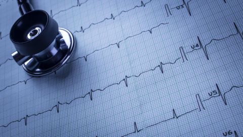 electrocardiograma